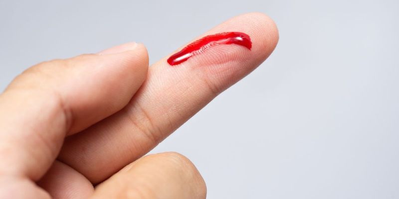 Chiêm bao máu đen đánh 13 hoặc 31